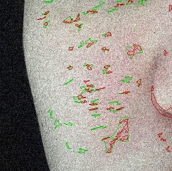 The Skin Barrier & Microbiome: Why They Matter